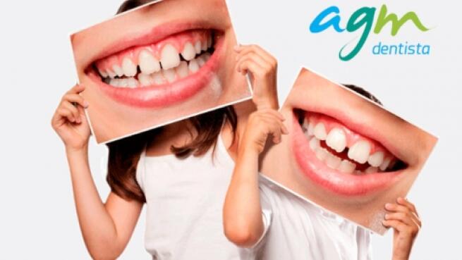 Revision Y Sellado O Empaste Para Ninos Y Adolescentes Por Oferta Con Descuento 50 Ofertas En Logrono Y La Rioja Oferplan La Rioja